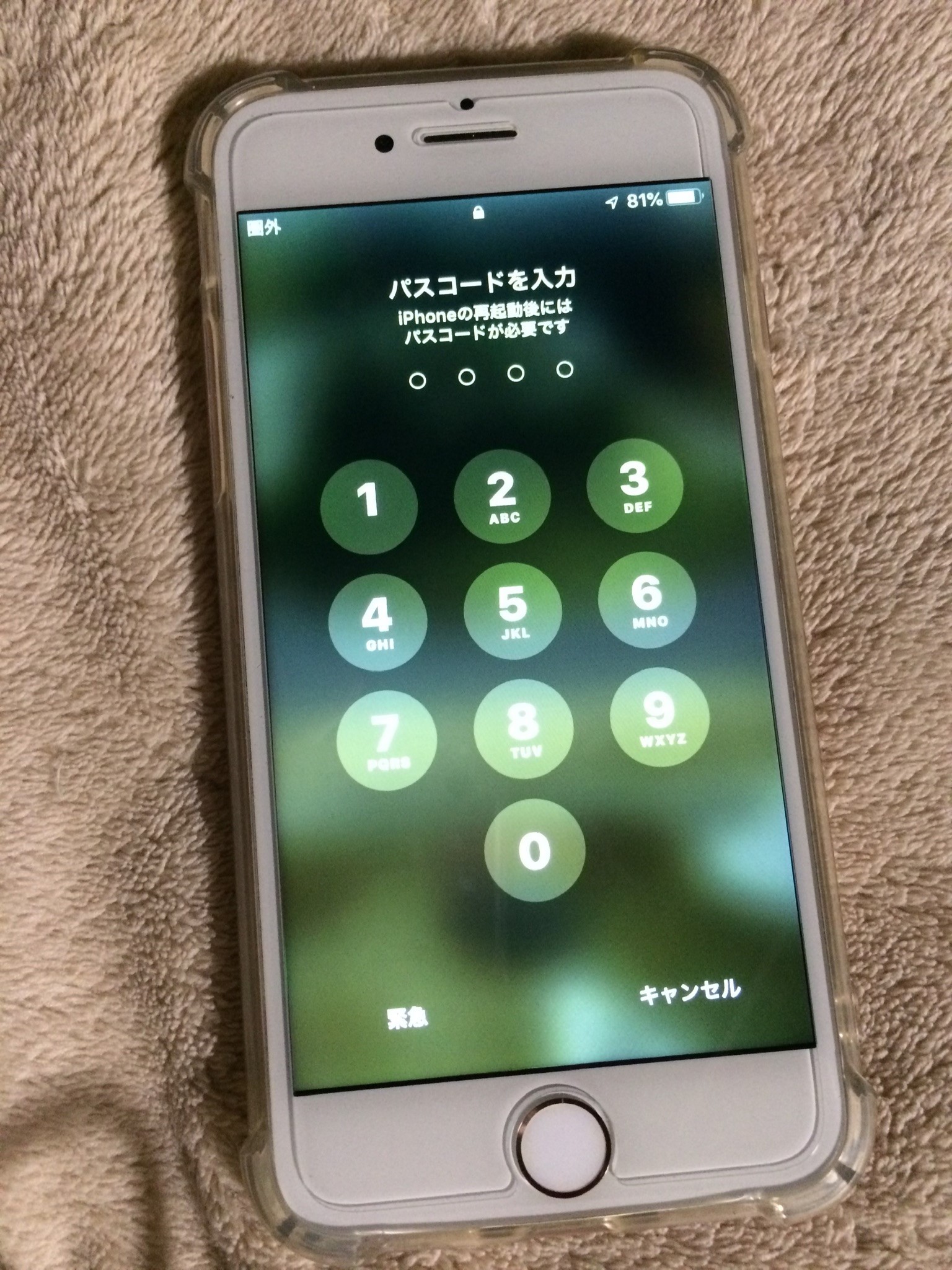 Iphone7 リコール